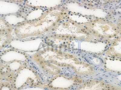 RTCB Antibody - DF14884 at 1/100 staining human normal kidney tissue by IHC-P.