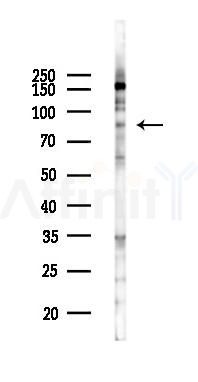 SLC6A5 Antibody - Western blot analysis of lysates from COLO205 cells(UV 30min treatment), using SLC6A5 Antibody at 1/1000 dilution.