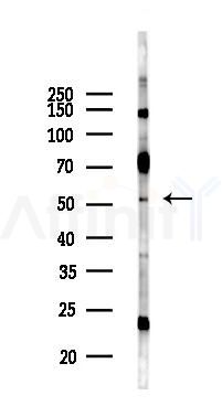 TOM1 Antibody - Western blot analysis of lysates from COLO205 cells(UV 30min treatment), using TOM1 Antibody at 1/1000 dilution.