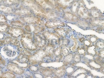 HERC3 Antibody - DF14895 at 1/100 staining human normal kidney tissue by IHC-P.