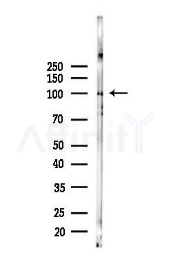 CIZ1 Antibody - Western blot analysis of lysates from Rat brain, using CIZ1 Antibody at 1/1000 dilution.