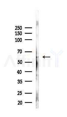 LRRTM1 Antibody - Western blot analysis of lysates from K562 cells(heat-shock 45min treatment), using LRRTM1 Antibody at 1/1000 dilution.