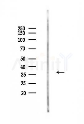 STX10 Antibody - Western blot analysis of lysates from Mouse liver, using STX10 Antibody at 1/1000 dilution.