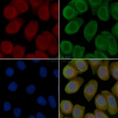 SLC51A Antibody - DF14931 staining Hela cells(45min of heat-shock treatment) by IF/ICC.
