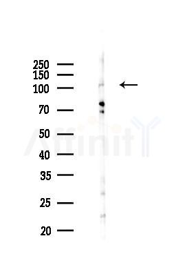WWP2 Antibody - Western blot analysis of lysates from 293 cells(UV 30min treatment), using WWP2 Antibody at 1/1000 dilution.