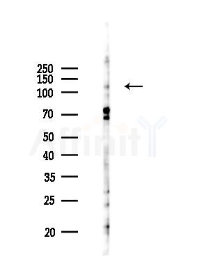 WWP2 Antibody - Western blot analysis of lysates from COLO205 cells(UV 30min treatment), using WWP2 Antibody at 1/1000 dilution.