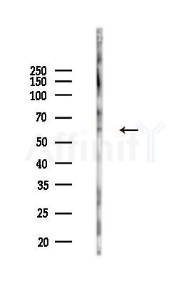 PVR Antibody - Western blot analysis of lysates from 293 cells(UV 30min treatment), using PVR Antibody at 1/1000 dilution.