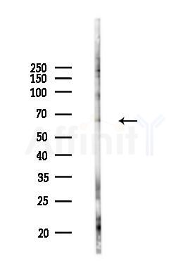 PVR Antibody - Western blot analysis of lysates from COLO205 cells(UV 30min treatment), using PVR Antibody at 1/1000 dilution.