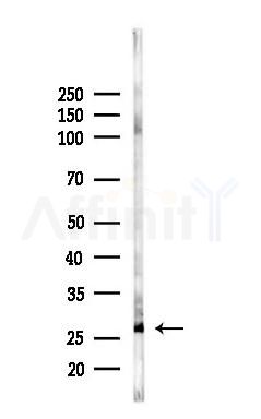RTP2 Antibody - Western blot analysis of lysates from Rat liver, using RTP2 Antibody at 1/1000 dilution.