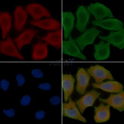 WDR73 Antibody - DF14942 staining Hela cells(30min of UV treatment) by IF/ICC.