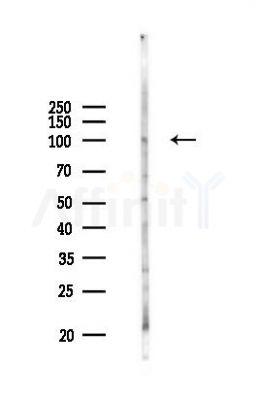 SCUBE1 Antibody - Western blot analysis of lysates from COLO205 cells(UV 30min treatment), using SCUBE1 Antibody at 1/1000 dilution.