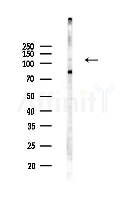 NLRP12 Antibody - Western blot analysis of lysates from 293 cells(UV 30min treatment), using NLRP12 Antibody at 1/1000 dilution.