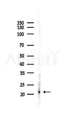 SPACA7 Antibody - Western blot analysis of lysates from Rat lung, using SPACA7 Antibody at 1/1000 dilution.