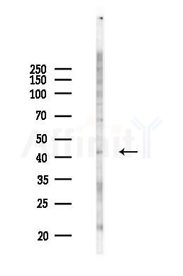 MTFR2 Antibody - Western blot analysis of lysates from COLO205 cells(UV 30min treatment), using MTFR2 Antibody at 1/1000 dilution.