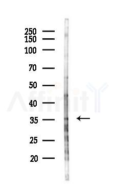 RHBDD1 Antibody - Western blot analysis of lysates from HUVEC cells(LPS 4h treatment), using RHBDD1 Antibody at 1/1000 dilution.