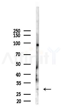 SYPL2 Antibody - Western blot analysis of lysates from A2780 cells(UV 30min treatment), using SYPL2 Antibody at 1/1000 dilution.