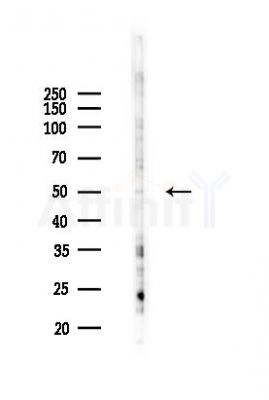 BFAR Antibody - Western blot analysis of lysates from 293 cells(UV 30min treatment), using BFAR Antibody at 1/1000 dilution.