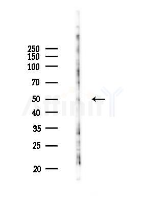 BFAR Antibody - Western blot analysis of lysates from COLO205 cells(UV 30min treatment), using BFAR Antibody at 1/1000 dilution.