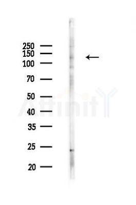 ZMYM1 Antibody - Western blot analysis of lysates from 293 cells(UV 30min treatment), using ZMYM1 Antibody at 1/1000 dilution.