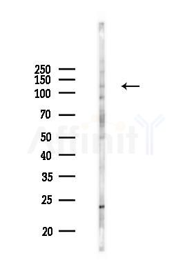 ZMYM1 Antibody - Western blot analysis of lysates from COLO205 cells(UV 30min treatment), using ZMYM1 Antibody at 1/1000 dilution.