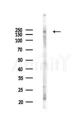 ZMYM3 Antibody - Western blot analysis of lysates from 293 cells(UV 30min treatment), using ZMYM3 Antibody at 1/1000 dilution.