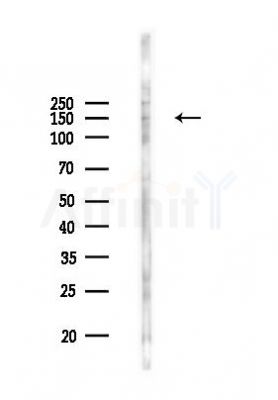 ZMYM3 Antibody - Western blot analysis of lysates from COLO205 cells(UV 30min treatment), using ZMYM3 Antibody at 1/1000 dilution.