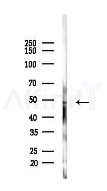 ZSCAN4 Antibody - Western blot analysis of lysates from A2780 cells(UV 30min treatment), using ZSCAN4 Antibody at 1/1000 dilution.