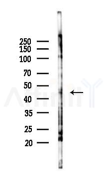 ERCC8 Antibody - Western blot analysis of lysates from PC12 cells(LPS 4h treatment), using ERCC8 Antibody at 1/1000 dilution.