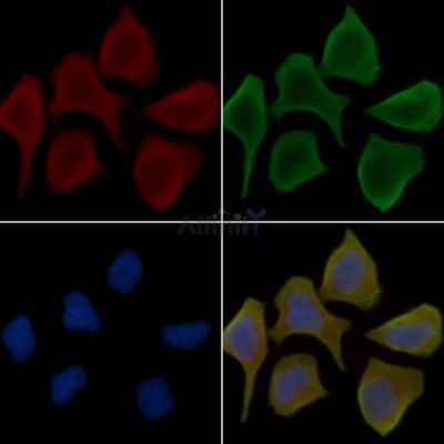 RNASET2 Antibody - DF14994 staining Hela cells(30min of UV treatment) by IF/ICC.
