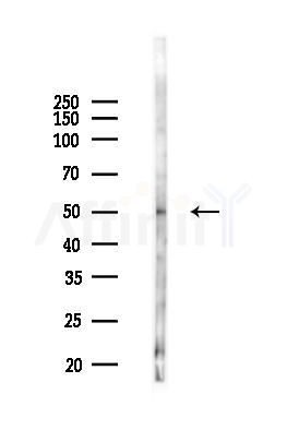 METTL4 Antibody - Western blot analysis of lysates from 293 cells(UV 30min treatment), using METTL4 Antibody at 1/1000 dilution.