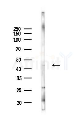 OTUD3 Antibody - Western blot analysis of lysates from 293 cells(UV 30min treatment), using OTUD3 Antibody at 1/1000 dilution.