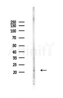 SERTAD3 Antibody - Western blot analysis of lysates from Mouse liver, using SERTAD3 Antibody at 1/1000 dilution.
