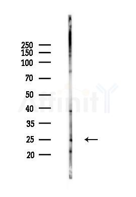 LAPTM5 Antibody - Western blot analysis of lysates from Rat testis, using LAPTM5 Antibody at 1/1000 dilution.