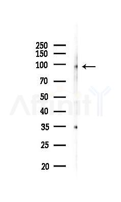 MEPE Antibody - Western blot analysis of lysates from Mouse lung, using MEPE Antibody at 1/1000 dilution.