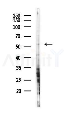 WDR41 Antibody - Western blot analysis of lysates from HUVEC cells(LPS 4h treatment), using WDR41 Antibody at 1/1000 dilution.
