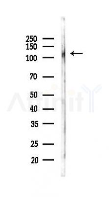 ANKRD27 Antibody - Western blot analysis of lysates from Rat lung, using ANKRD27 Antibody at 1/1000 dilution.