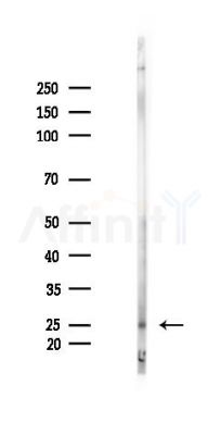 MXD4 Antibody - Western blot analysis of lysates from Rat liver, using MXD4 Antibody at 1/1000 dilution.