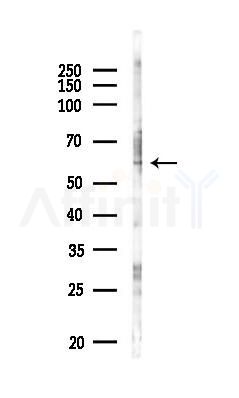 RABGEF1 Antibody - Western blot analysis of lysates from PC12 cells(LPS 4h treatment), using RABGEF1 Antibody at 1/1000 dilution.