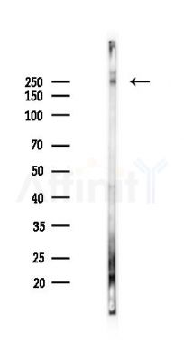CASP8AP2 Antibody - Western blot analysis of lysates from K562 cells(starvation 24h treatment), using CASP8AP2 Antibody at 1/1000 dilution.