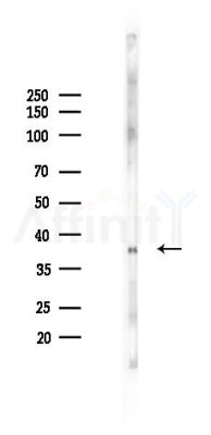 CTAG1A; CTAG1B Antibody - Western blot analysis of lysates from K562 cells(starvation 24h treatment), using CTAG1A; CTAG1B Antibody at 1/1000 dilution.