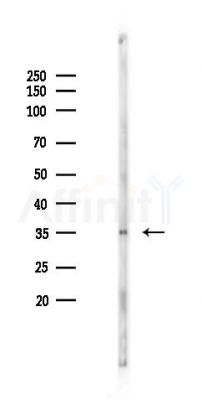 CTAG1A; CTAG1B Antibody - Western blot analysis of lysates from B16F10-LUC cells(starvation 24h treatment), using CTAG1A; CTAG1B Antibody at 1/1000 dilution.