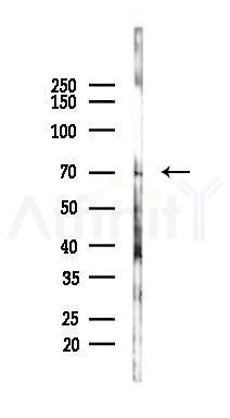 RIOX1 Antibody - Western blot analysis of lysates from A2780 cells(UV 30min treatment), using RIOX1 Antibody at 1/1000 dilution.