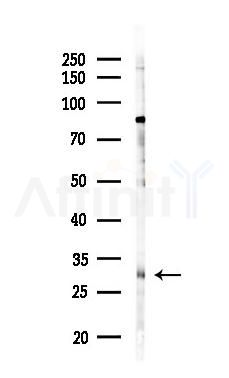 ZNRF2 Antibody - Western blot analysis of lysates from PC12 cells(LPS 4h treatment), using ZNRF2 Antibody at 1/1000 dilution.