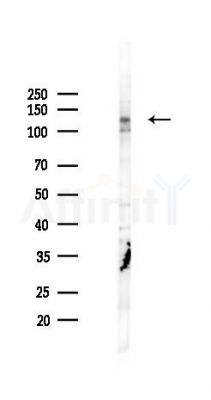 PCNX4 Antibody - Western blot analysis of lysates from K562 cells(starvation 24h treatment), using PCNX4 Antibody at 1/1000 dilution.