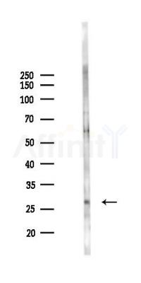 APH1B Antibody - Western blot analysis of lysates from B16F10-LUC cells(heat-shock 45min treatment), using APH1B Antibody at 1/1000 dilution.