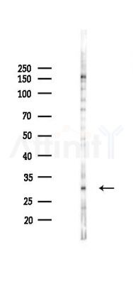 SLC39A3 Antibody - Western blot analysis of lysates from K562 cells(starvation 24h treatment), using SLC39A3 Antibody at 1/1000 dilution.