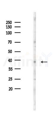 SLC39A3 Antibody - Western blot analysis of lysates from B16F10-LUC cells(starvation 24h treatment), using SLC39A3 Antibody at 1/1000 dilution.