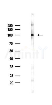 ATG9B Antibody - Western blot analysis of lysates from K562 cells(starvation 24h treatment), using ATG9B Antibody at 1/1000 dilution.