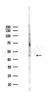 MFSD1 Antibody - Western blot analysis of lysates from B16F10-LUC cells(heat-shock 45min treatment), using MFSD1 Antibody at 1/1000 dilution.