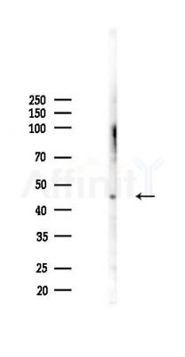 MFSD1 Antibody - Western blot analysis of lysates from K562 cells(heat-shock 45min treatment), using MFSD1 Antibody at 1/1000 dilution.